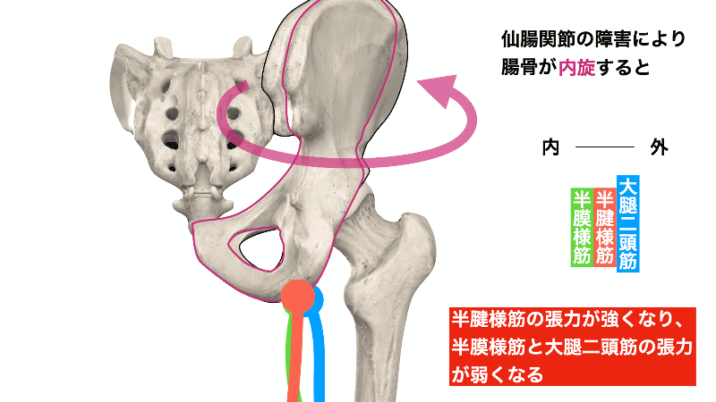 ハムストリングスの調整 アギトス鍼灸整骨院 ハムストリングスの調整 アギトス鍼灸整骨院